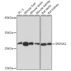SRD5A2 Rabbit mAb
