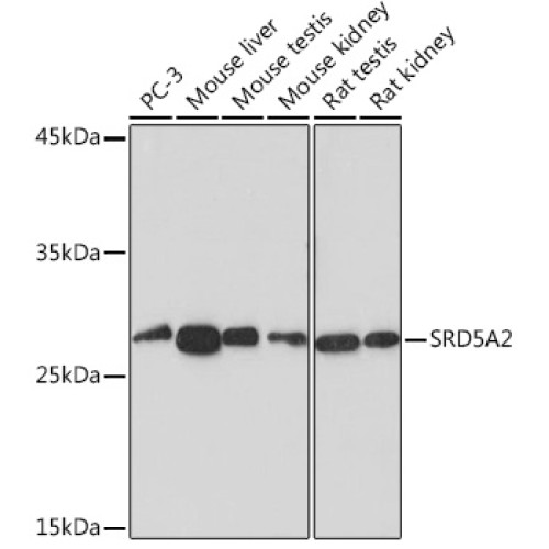 SRD5A2 Rabbit mAb