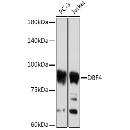 DBF4 Rabbit mAb