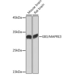 EB3/MAPRE3 Rabbit mAb