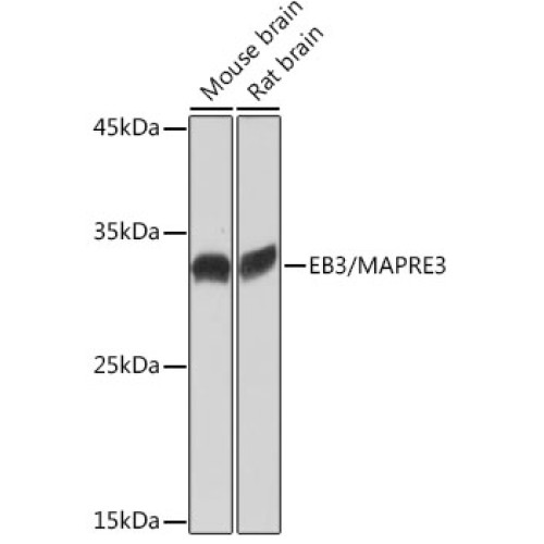 EB3/MAPRE3 Rabbit mAb