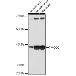TMOD2 Rabbit mAb