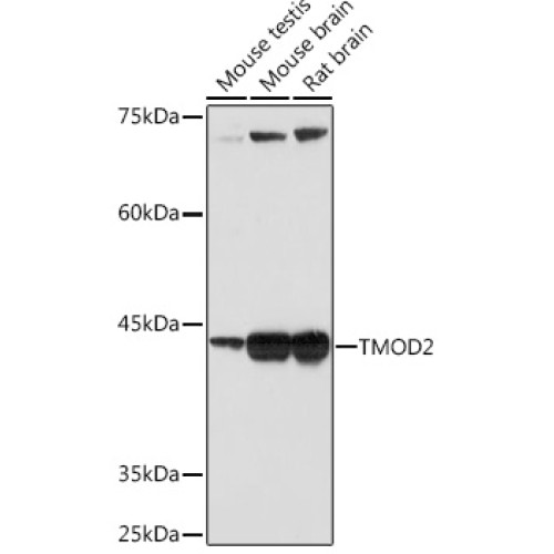 TMOD2 Rabbit mAb