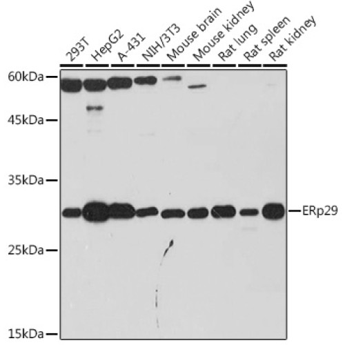 ERp29 Rabbit mAb