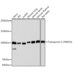 Transportin 3 (TNPO3) Rabbit mAb