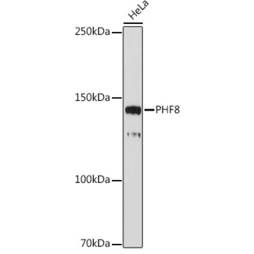 PHF8 Rabbit mAb