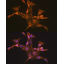 Nesprin 1 Rabbit mAb