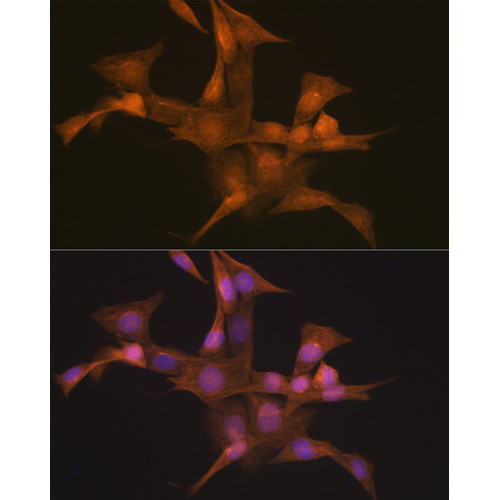 Nesprin 1 Rabbit mAb