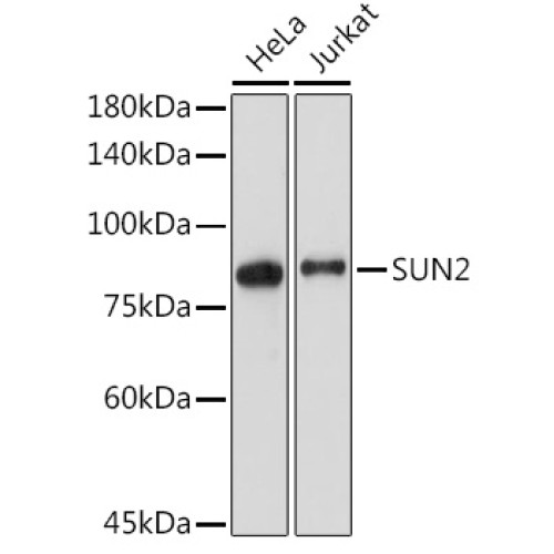 SUN2 Rabbit mAb