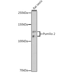 Pumilio 2 Rabbit mAb