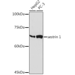 sestrin 1 Rabbit mAb