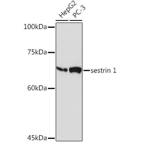 sestrin 1 Rabbit mAb