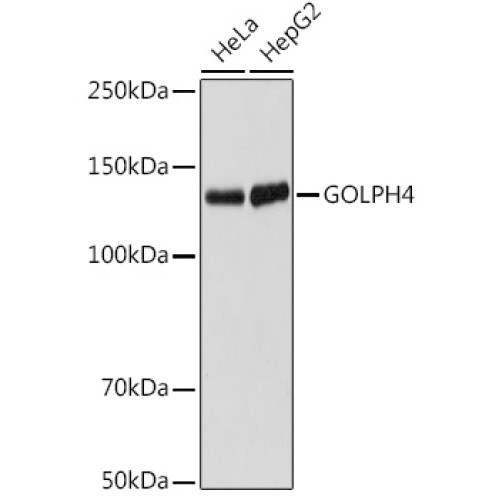 GOLPH4 Rabbit mAb