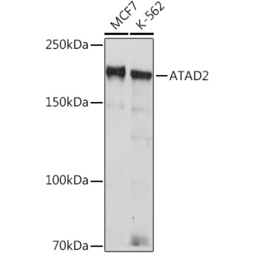 ATAD2 Rabbit mAb
