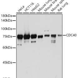 CDC40 Rabbit mAb
