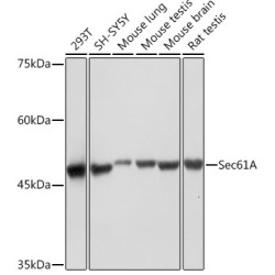 Sec61A Rabbit mAb