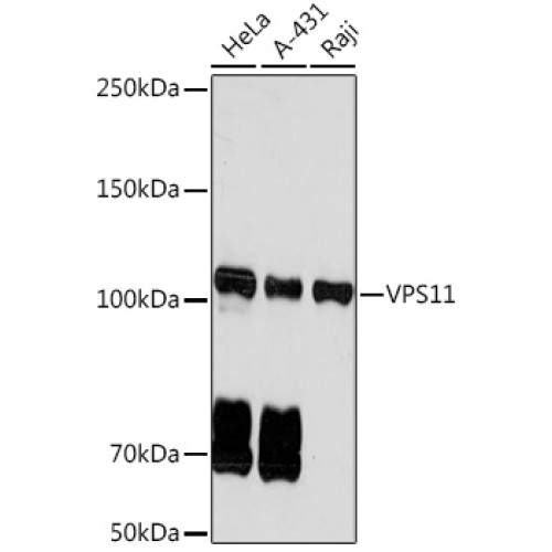 VPS11 Rabbit mAb