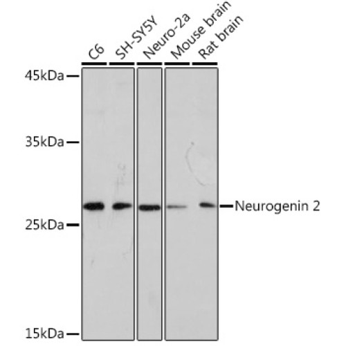 Neurogenin 2 Rabbit mAb