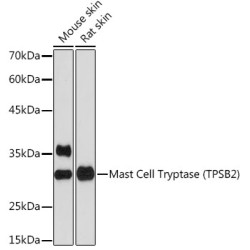 Mast Cell Tryptase (TPSB2) Rabbit mAb