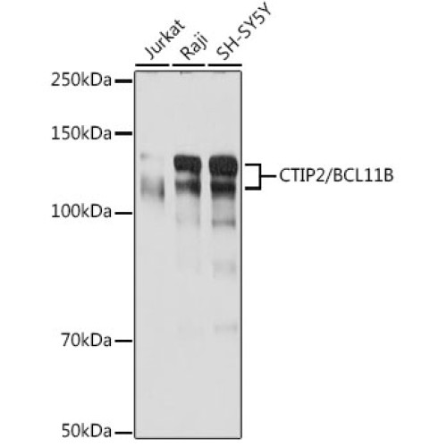 CTIP2/BCL11B Rabbit mAb