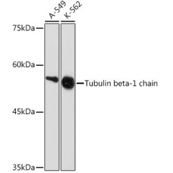 Tubulin beta-1 chain Rabbit mAb