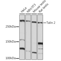 Talin 2 Rabbit mAb