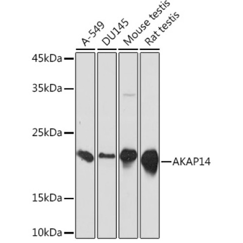 AKAP14 Rabbit mAb