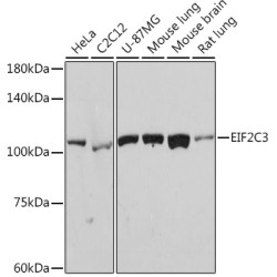 eIF2C3 Rabbit mAb