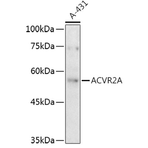 ACVR2A Rabbit pAb