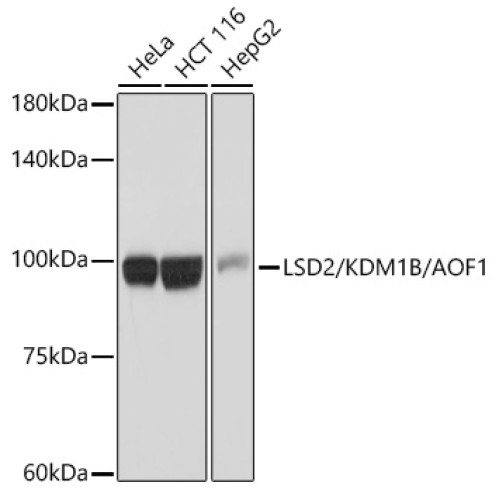 LSD2/KDM1B/AOF1 Rabbit mAb