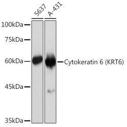 Cytokeratin 6 (KRT6) Rabbit mAb
