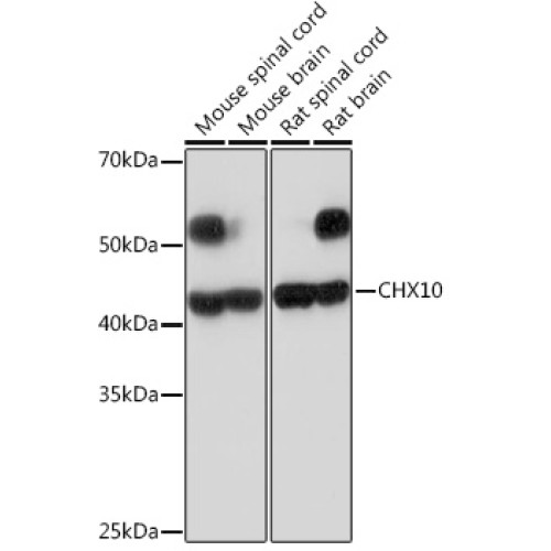 CHX10 Rabbit mAb