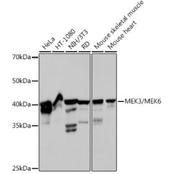 MEK3/MEK6 Rabbit mAb