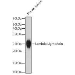 Lambda Light chain Rabbit mAb
