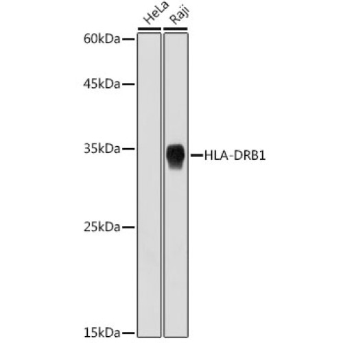 HLA-DRB1 Rabbit mAb
