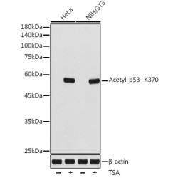 Acetyl-p53- K370 Rabbit mAb