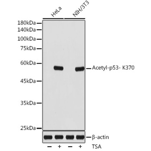 Acetyl-p53- K370 Rabbit mAb