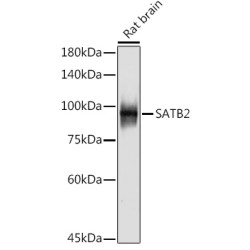 SATB2 Rabbit mAb