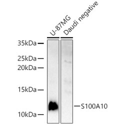 S100A10 Rabbit pAb