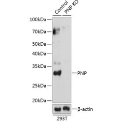 [KO Validated] PNP Rabbit pAb