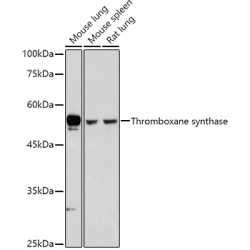 Thromboxane synthase Rabbit pAb
