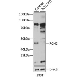 [KO Validated] RCN2 Rabbit pAb
