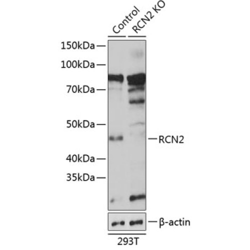 [KO Validated] RCN2 Rabbit pAb