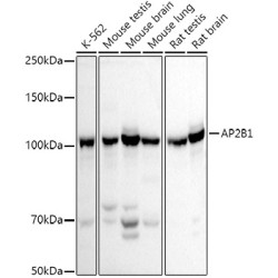 AP2B1 Rabbit pAb