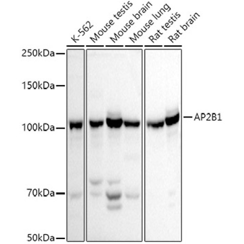 AP2B1 Rabbit pAb