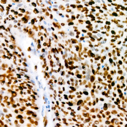 [KO Validated] Ki67 Rabbit mAb