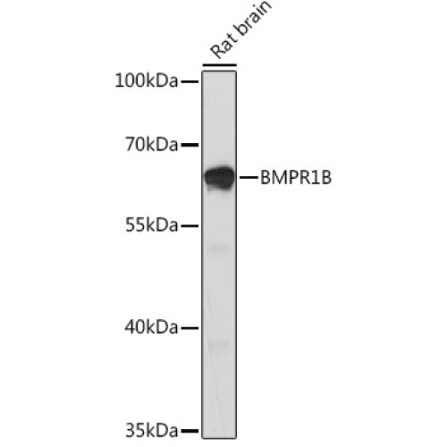 BMPR1B Rabbit pAb