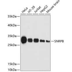 SNRPB Rabbit pAb