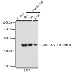 SARS-CoV-2 N Protein Mouse mAb