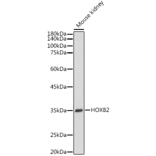 HOXB2 Rabbit pAb